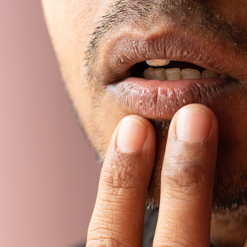 Dry Mouth