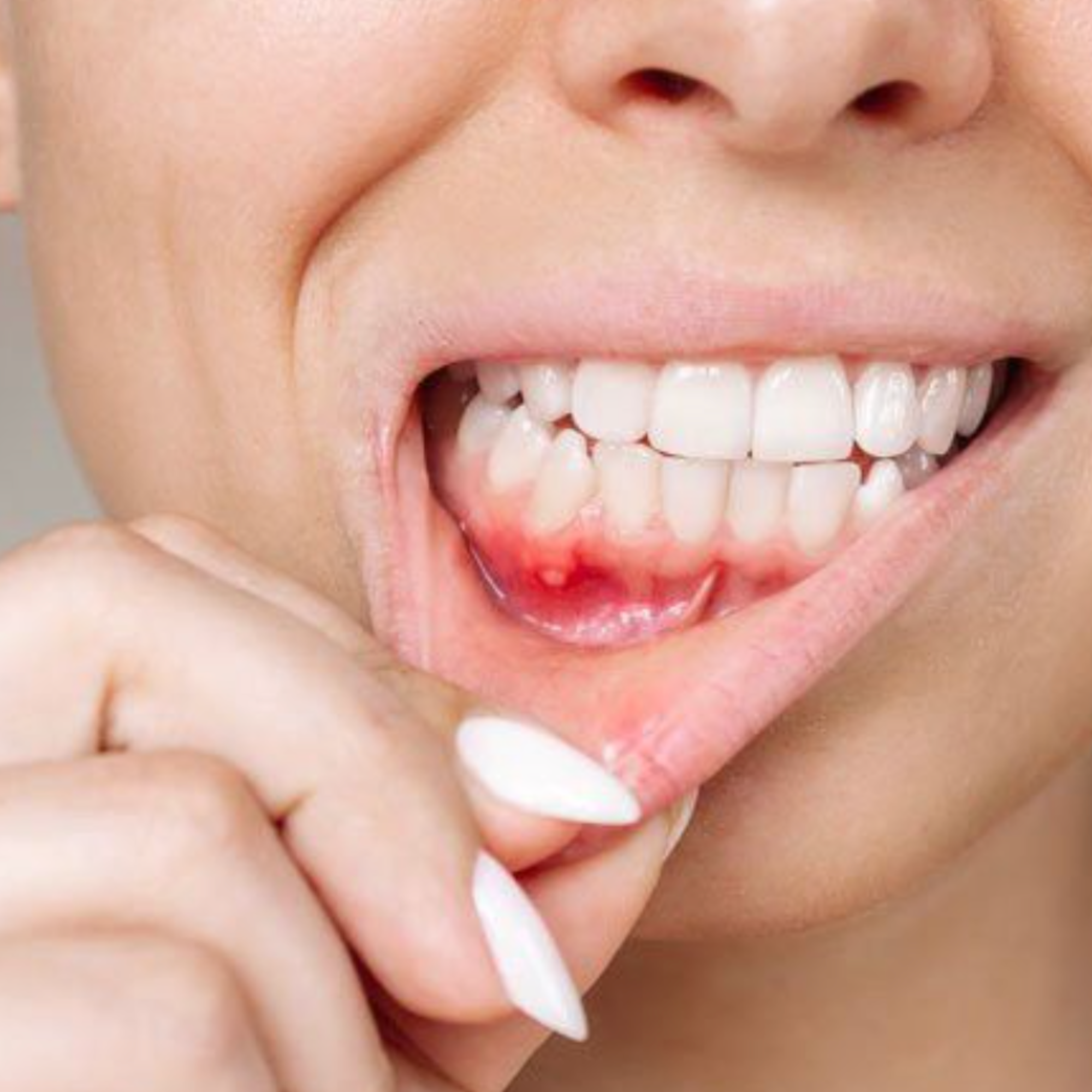 gums itch