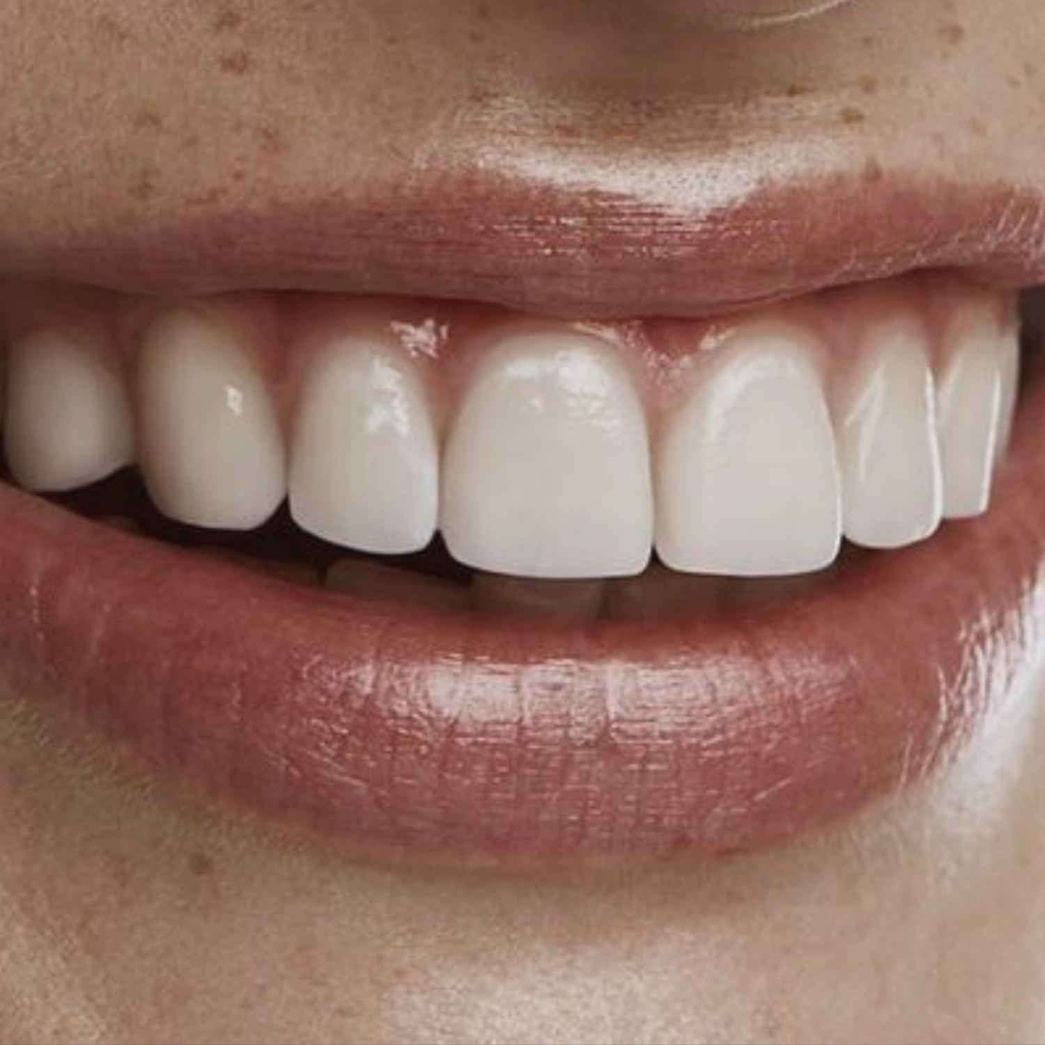 Gentle Whitening Oral Care